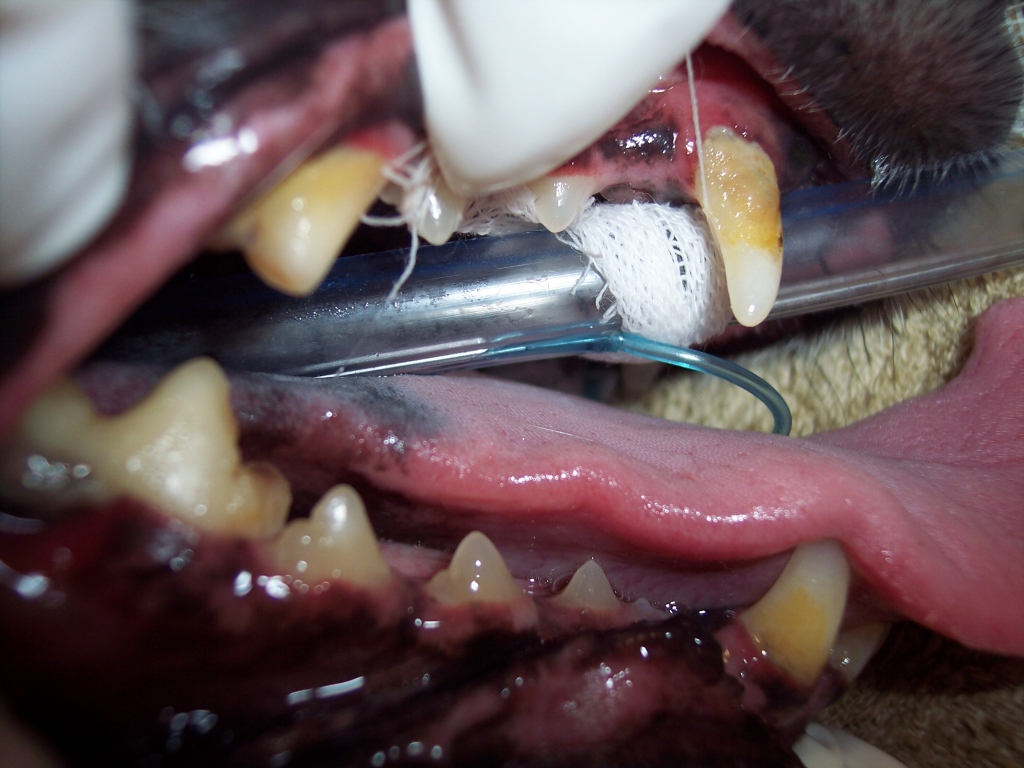Dental Disease Dental Disease